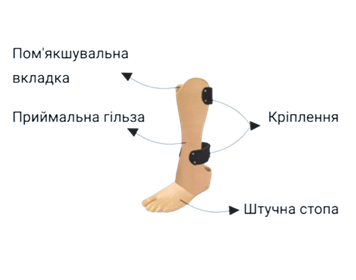 З чого складається протез стопи?