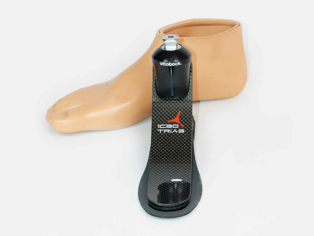 Виготовлення протезу стопи