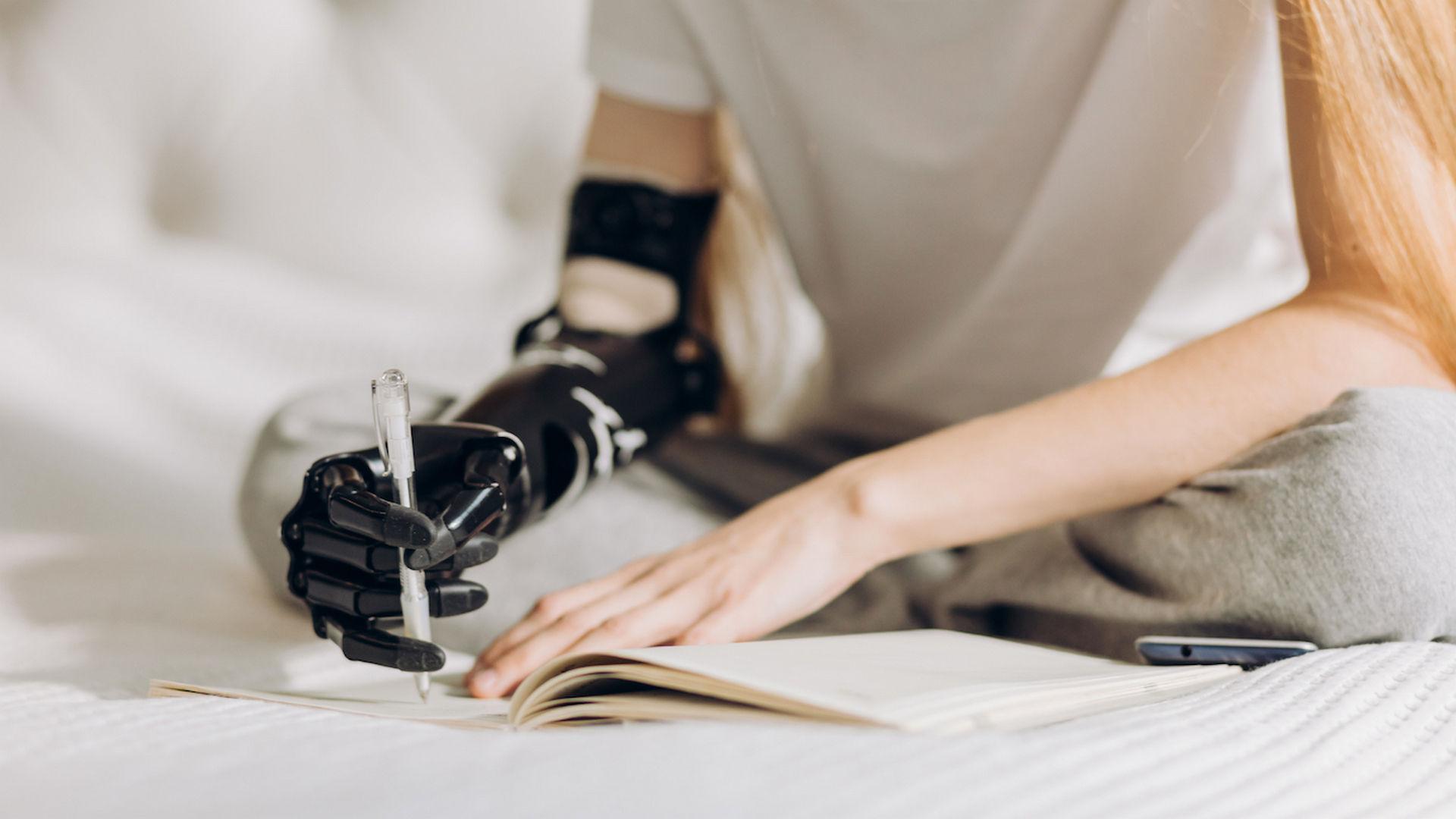 Що можна робити за допомогою міоелектричного протеза?